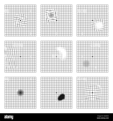 amsler recording chart|Amsler Grid: What It Is, How to Use It, and More .